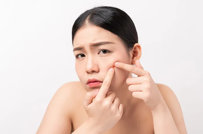 4 tips jitu memencet jerawat